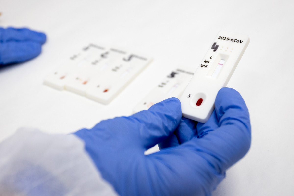 Aragón detecta 433 casos de COVID-19, procedentes de 3.961 PCR.
