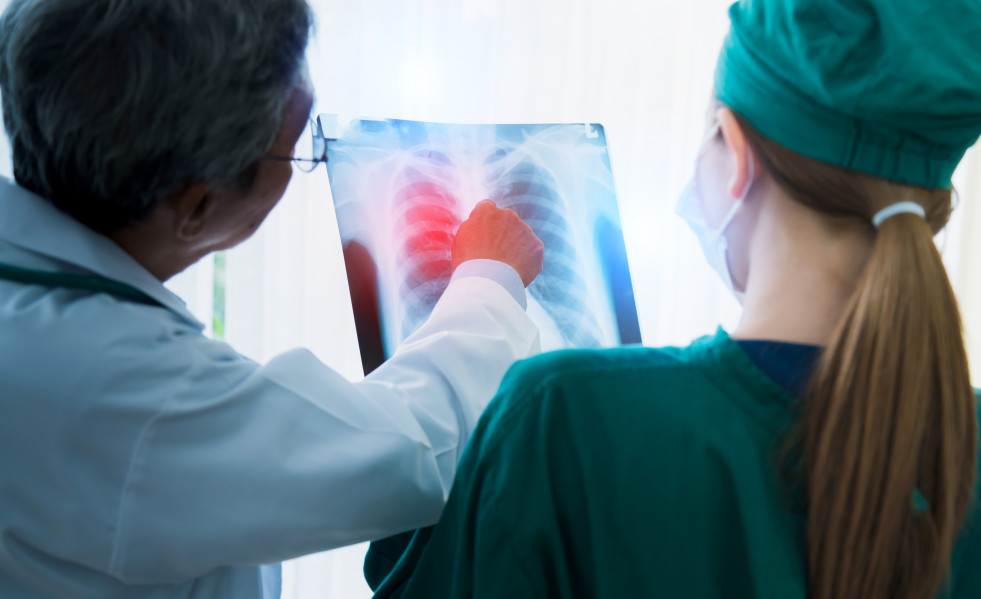 Asian doctor team examine xray film patient analysis find bext solution operation treat health ideas concept
