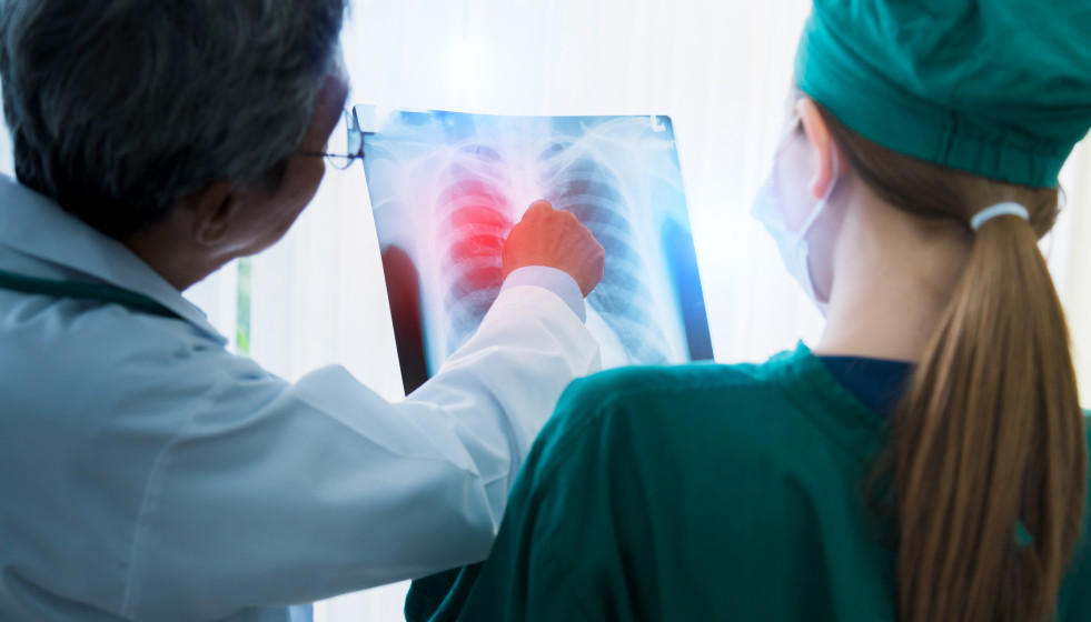Asian doctor team examine xray film patient analysis find bext solution operation treat health ideas concept