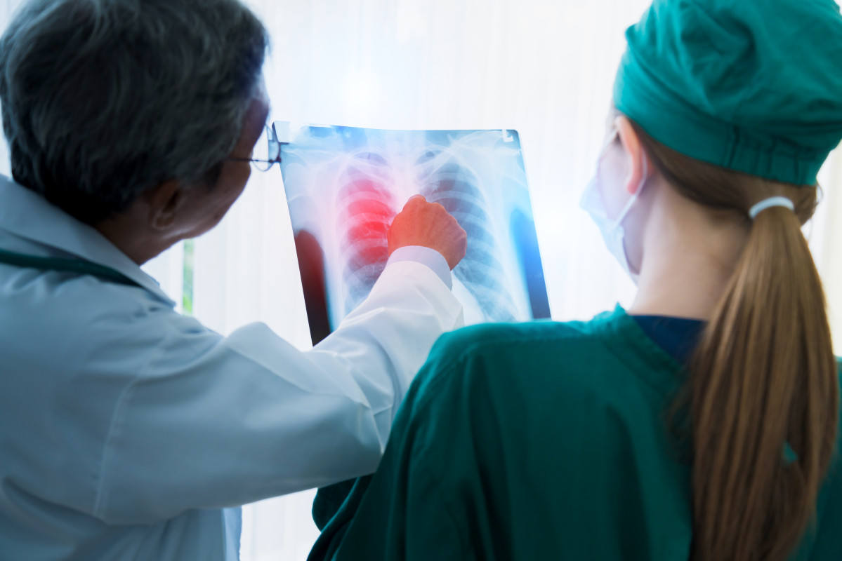 Asian doctor team examine xray film patient analysis find bext solution operation treat health ideas concept